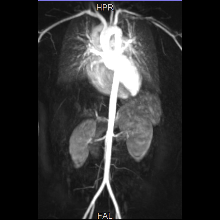 Dr Ebner_aorta MR